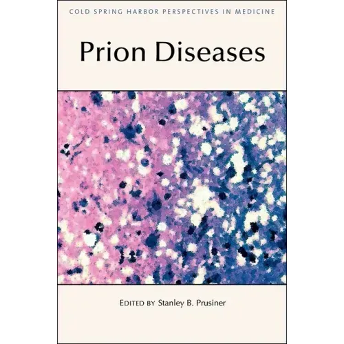 Prion Diseases