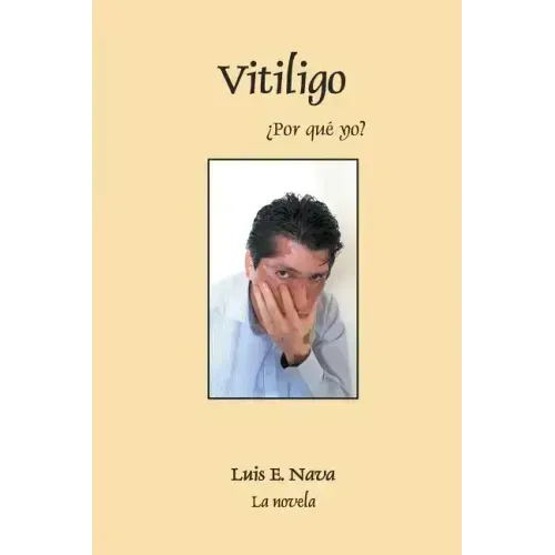 Vitiligo
