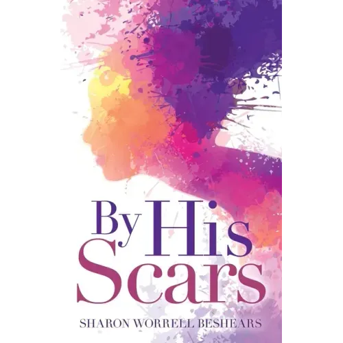 By His Scars