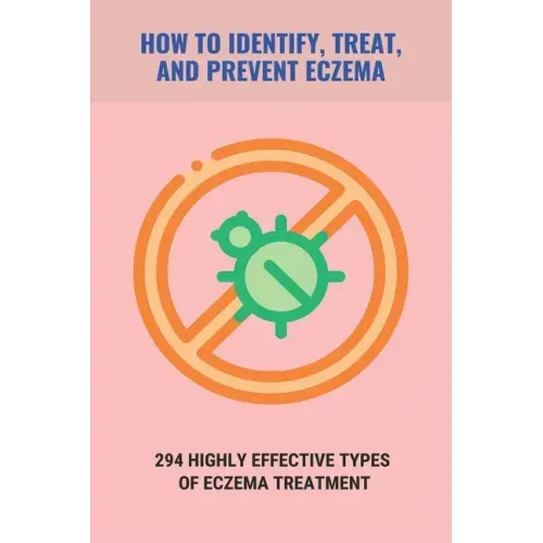 How To Identify, Treat, And Prevent Eczema: 294 Highly Effective Types Of Eczema Treatment: How To Cure Eczema Fast