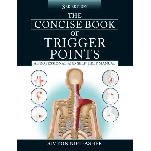 The Concise Book of Trigger Points, Third Edition: A Professional and Self-Help Manual