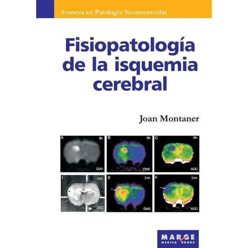 Fisiopatología de la isquemia cerebral