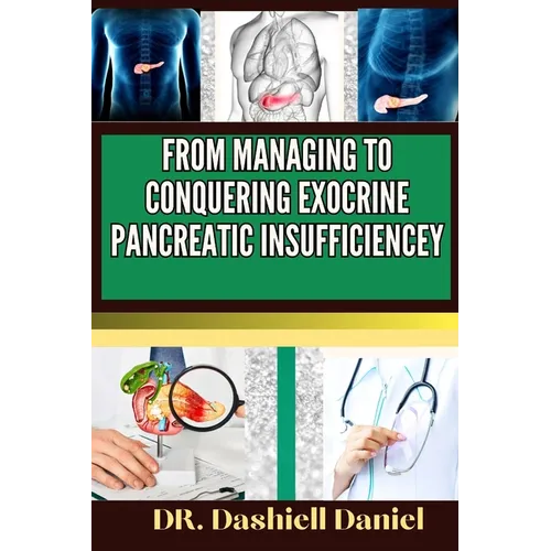 From Managing to Conquering Exocrine Pancreatic Insufficiencey: Expert guide to Understanding EPI Causes, Decoding Symptoms, and Navigating Treatment