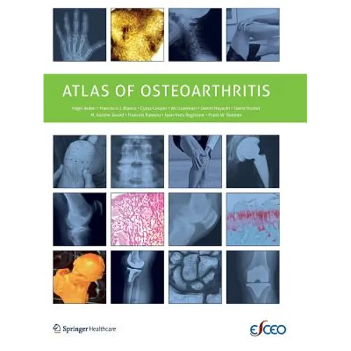 Atlas of Osteoarthritis