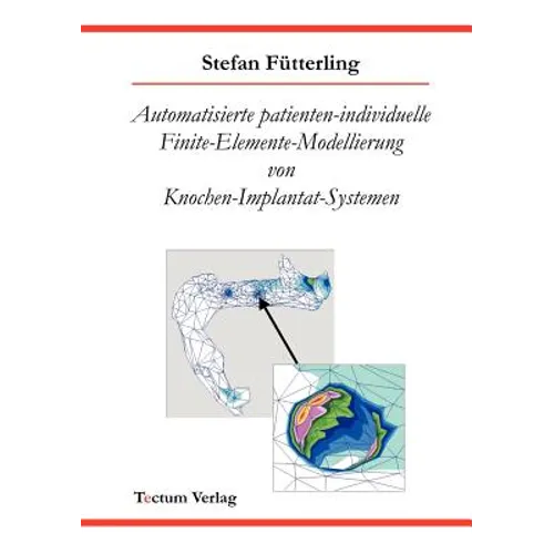Automatisierte patienten-individuelle Finite-Elemente-Modellierung von Knochen-Implantat-Systemen