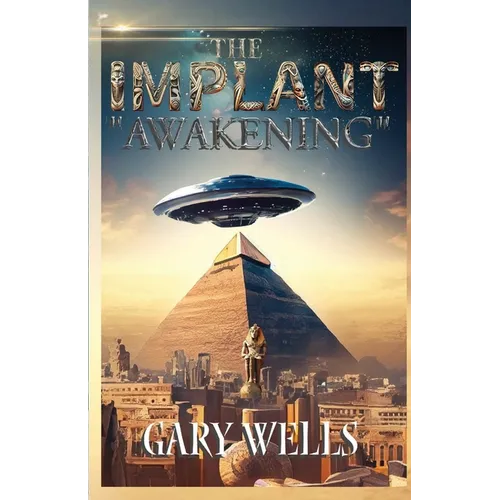The Implant Awakening