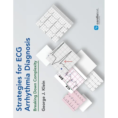 Strategies for ECG Arrhythmia Diagnosis: Breaking Down Comlexity: Breaking Down Complexity