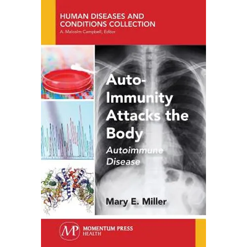 Auto-Immunity Attacks the Body: Autoimmune Disease