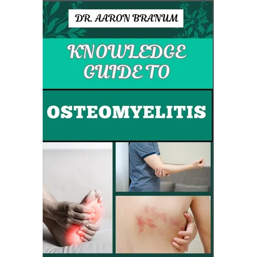 Knowledge Guide to Osteomyelitis: Essential Manual To Diagnosis, Treatment, Prevention, and Advanced Therapies for Bone Infection Management