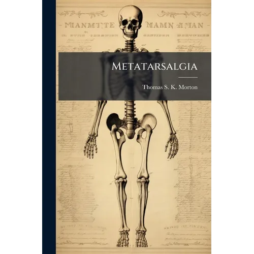 Metatarsalgia