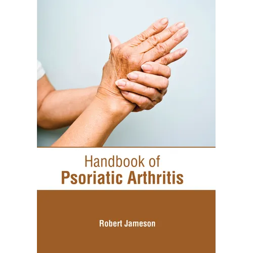 Handbook of Psoriatic Arthritis
