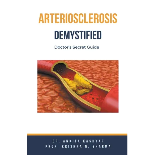 Arteriosclerosis Demystified: Doctor's Secret Guide