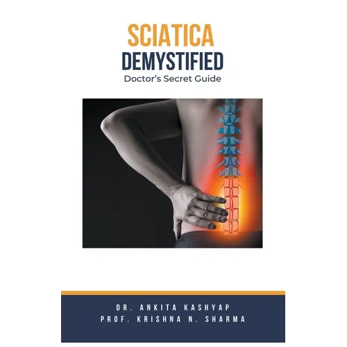 Sciatica Demystified: Doctor's Secret Guide