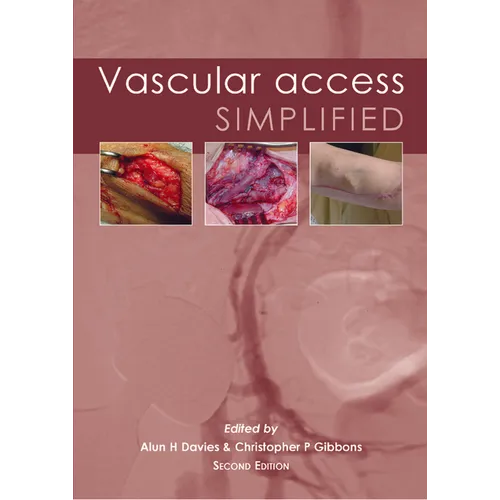 Vascular Access Simplified; Second Edition