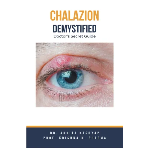 Chalazion Demystified: Doctor's Secret Guide