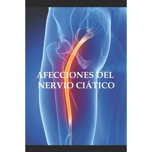 Afecciones del nervio ciático