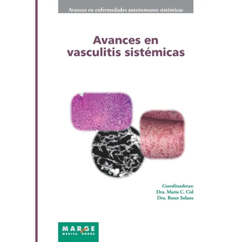 Avances en vasculitis sistémicas