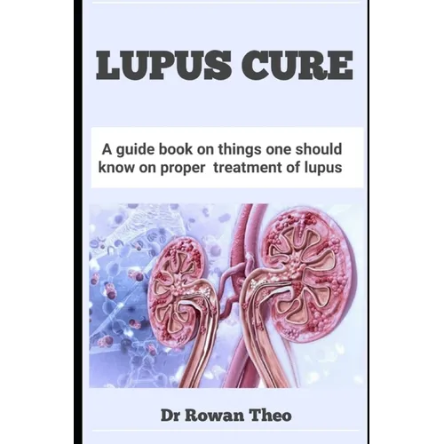 Lupus Cure: A guide book on things one should know on proper treatment of lupus