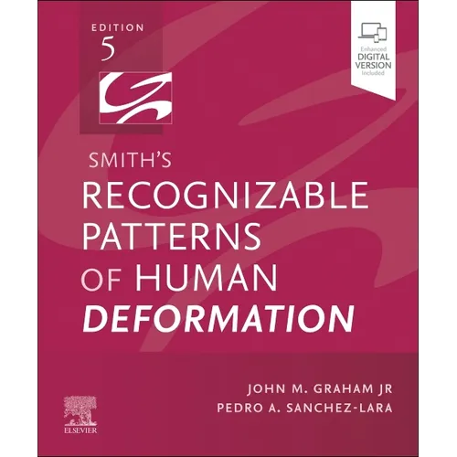 Smith's Recognizable Patterns of Human Deformation