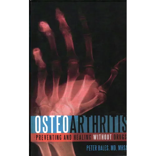 Osteoarthritis: Preventing and Healing Without Drugs