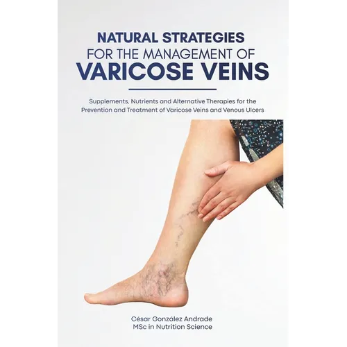 Natural Strategies for the Management of Varicose Veins: Supplements, Nutrients and Alternative Therapies for the Prevention and Treatment of Varicose