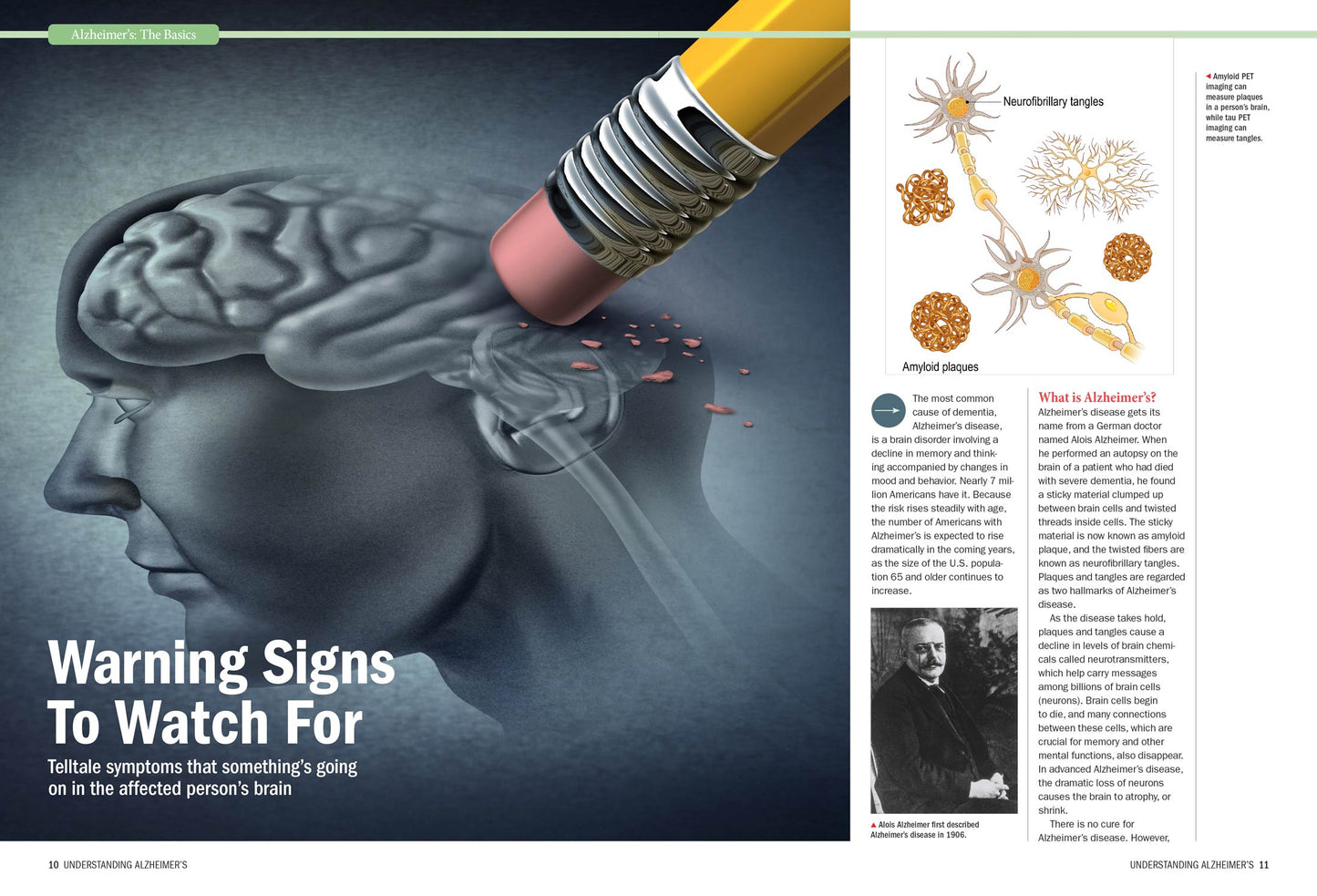 Harvard Health -  Alzheimer's Disease:  A Complete Guide To Reduce Risks, Treatment Options, Symptoms, Therapies, Support Strategies, Preventative Care, Medications, Understanding Alzheimer's & More!