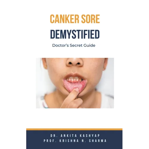 Canker Sore Demystified: Doctor's Secret Guide