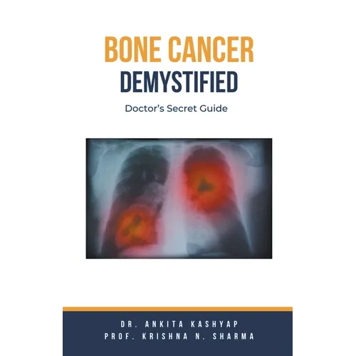 Bone Cancer Demystified: Doctor's Secret Guide