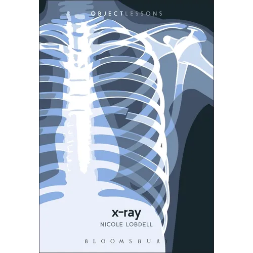 X-Ray