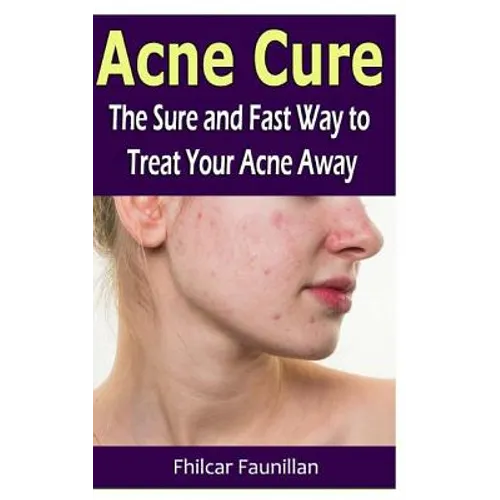 Acne Cure: The Sure and Fast Way to Treat Your Acne Away