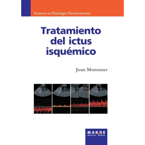 Tratamiento del ictus isquémico