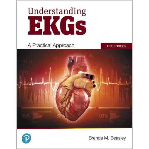 Understanding EKGs: A Practical Approach
