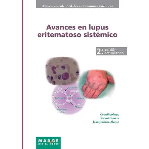 Avances en lupus eritematoso sistémico
