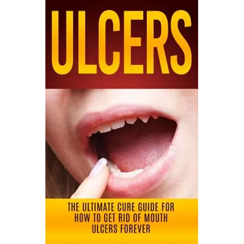 Ulcers: The Ultimate Cure Guide for How to Get Rid of Mouth Ulcers Instantly