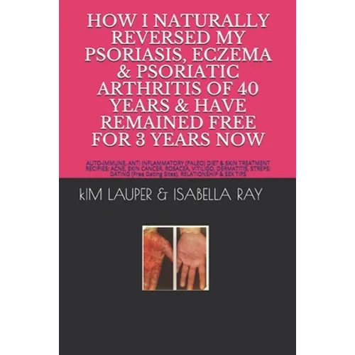 How I Naturally Reversed My Psoriasis, Eczema and Psoriatic Arthritis of 40 Years and Have Remained Free for 3 Years Now: AUTO IMMUNE, GLUTEN FREE, DA