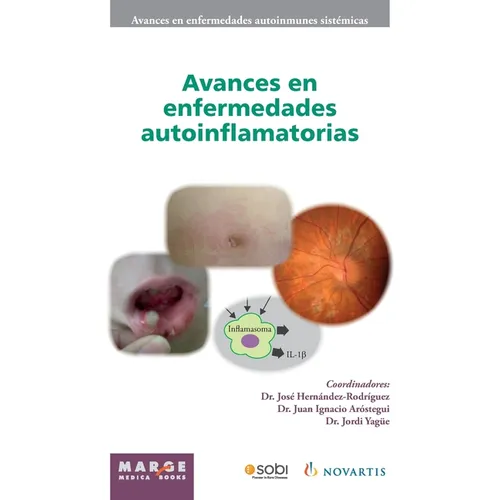 Avances en enfermedades autoinflamatorias
