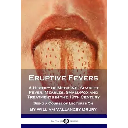 Eruptive Fevers: A History of Medicine - Scarlet Fever, Measles, Small-Pox and Treatments in the 19th Century - Being a Course of Lectures On
