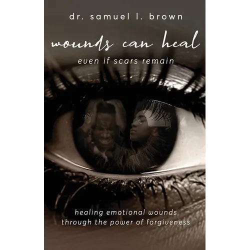 Wounds Can Heal, Even If Scars Remain