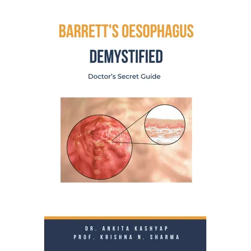 Barretts Oesophagus Demystified: Doctor's Secret Guide