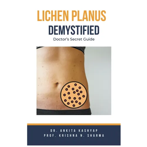 Lichen Planus Demystified Doctors Secret Guide