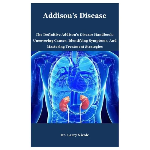 Addison's Disease: The Definitive Addison's Disease Handbook: Uncovering Causes, Identifying Symptoms, And Mastering Treatment Strategies