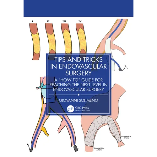 Tips and Tricks in Endovascular Surgery: A How to Guide for Reaching the Next Level in Endovascular Surgery
