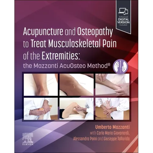 Acupuncture and Osteopathy to Treat Musculoskeletal Pain of the Extremities: The Mazzanti Acuosteo Method(r)