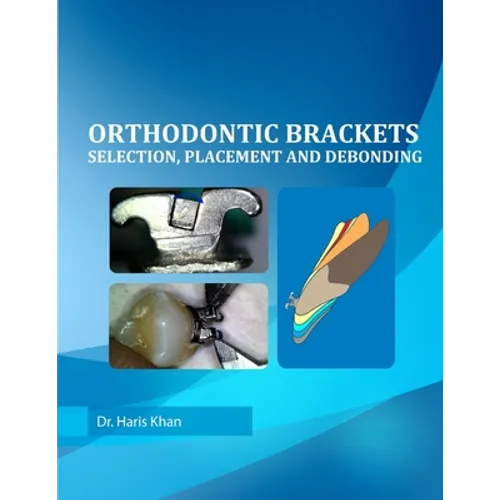 Orthodontic Brackets: Selection, Placement and Debonding - Paperback