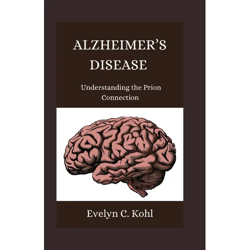 Alzheimer's Disease: Understanding the Prion Connection