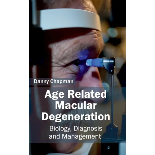 Age Related Macular Degeneration: Biology, Diagnosis and Management