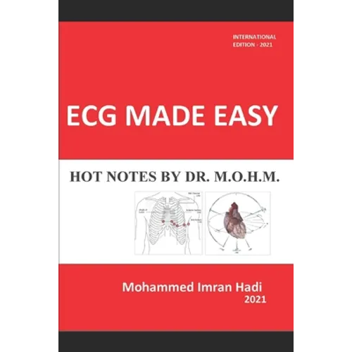ECG Made Easy: Hot Notes by Dr. M.O.H.M.