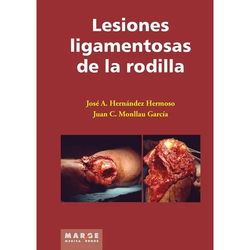 Lesiones ligamentosas de la rodilla