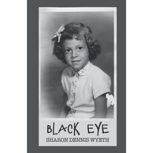 Black Eye