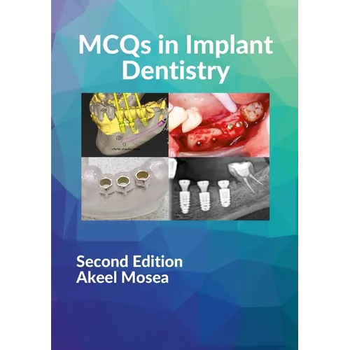 MCQs in Implant Dentistry